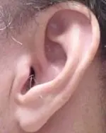 human-ear-bg.webp