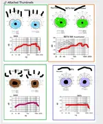 Annotation 2020-03-07 201256.webp