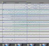audio-video sync.webp